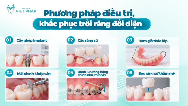 lam troi rang 3 Phương pháp điều trị, khắc phục trồi răng đối diện