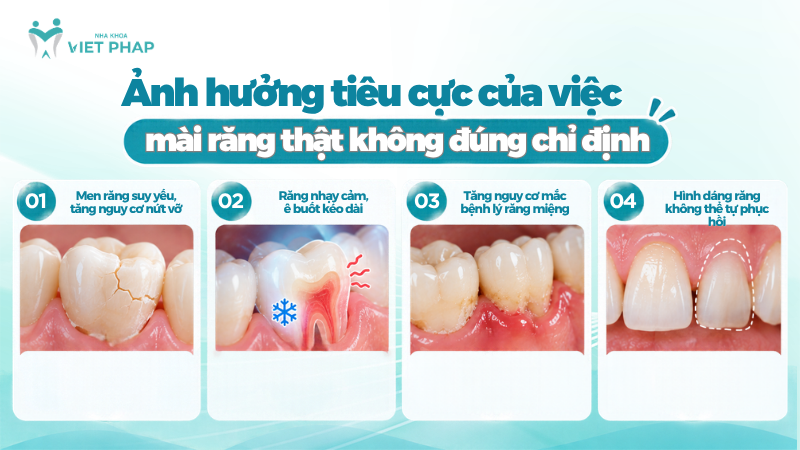 Những ảnh hưởng tiêu cực khi mài răng thật không đúng chỉ định