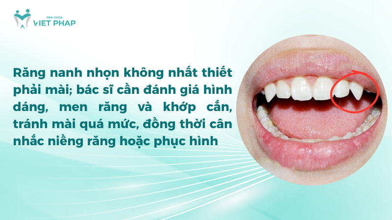 Răng nanh nhọn cần được bác sĩ đánh giá trước khi quyết định mài