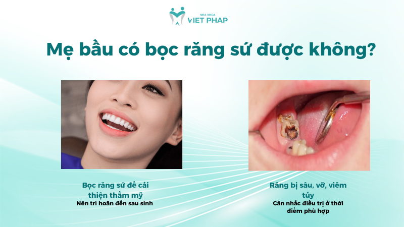 Mẹ bầu có bọc răng sứ được không?
