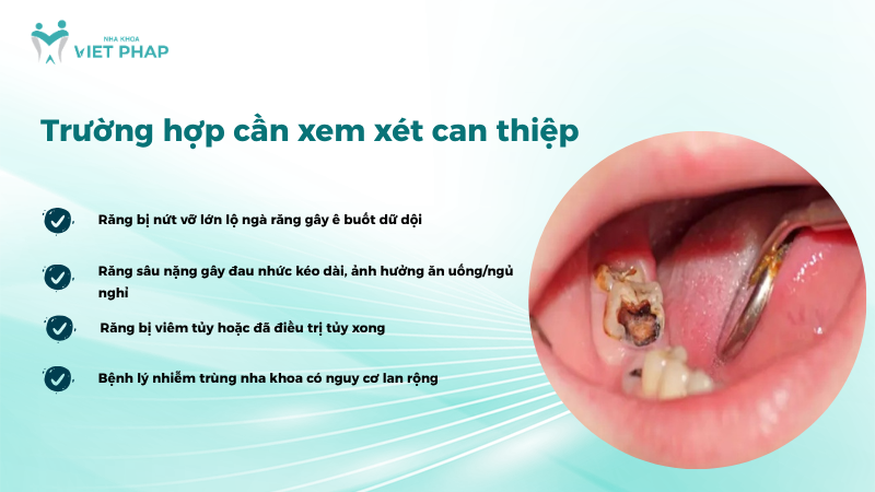 Trường hợp cần xem xét can thiệp