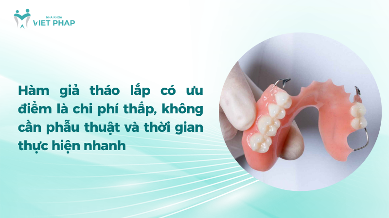 Hàm giả tháo lắp có ưu điểm là chi phí thấp, không cần phẫu thuật và thời gian thực hiện nhanh