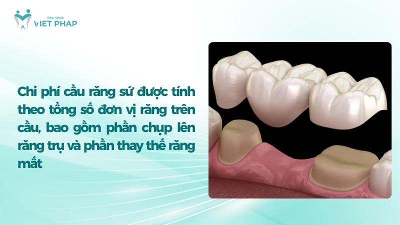 Chi phí cầu răng sứ được tính theo tổng số đơn vị răng trên cầu, bao gồm phần chụp lên răng trụ và phần thay thế răng mất