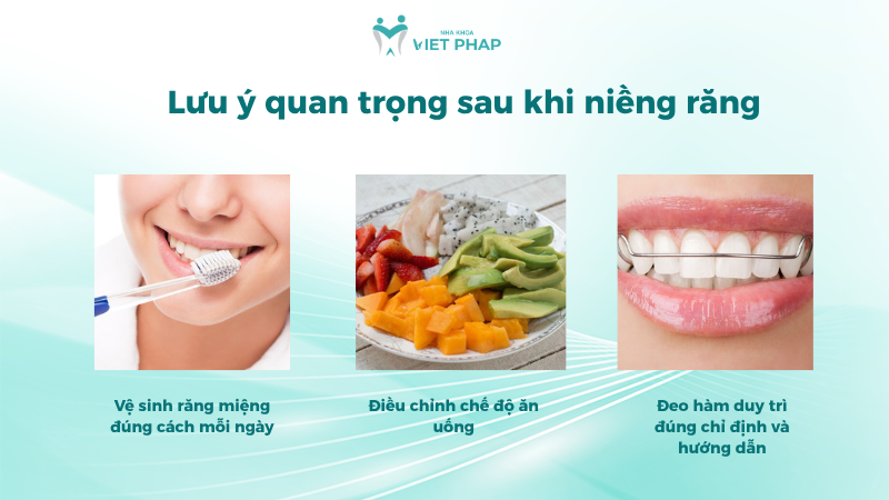 Lưu ý quan trọng sau khi niềng răng