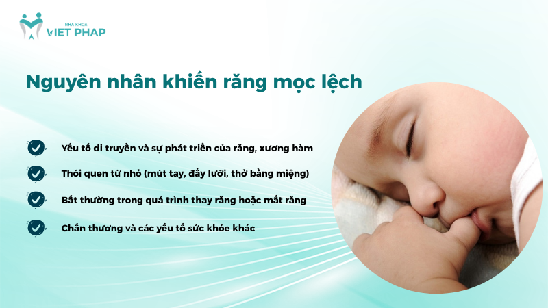 Nguyên nhân khiến răng mọc lệch