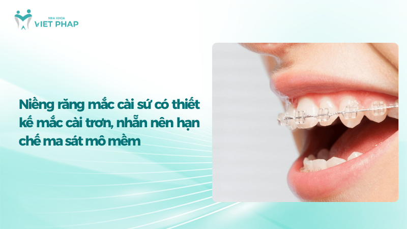 Niềng răng mắc cài sứ có thiết kế mắc cài trơn, nhẵn nên hạn chế ma sát mô mềm