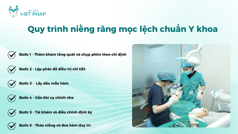 Quy trình niềng răng mọc lệch chuẩn Y khoa