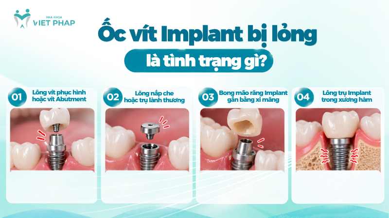 Các dạng ốc vít Implant bị lỏng thường gặp