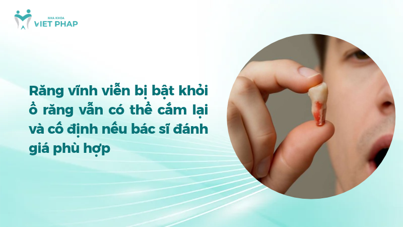 Người cầm chiếc răng vĩnh viễn bị bật khỏi ổ và thông tin về khả năng cắm lại
