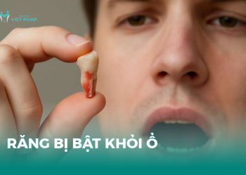 Răng bị bật khỏi ổ và cách xử lý sau chấn thương
