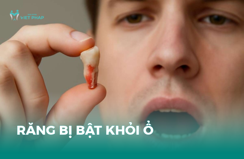 Răng bị bật khỏi ổ và cách xử lý sau chấn thương