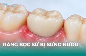 Răng bọc sứ bị sưng nướu