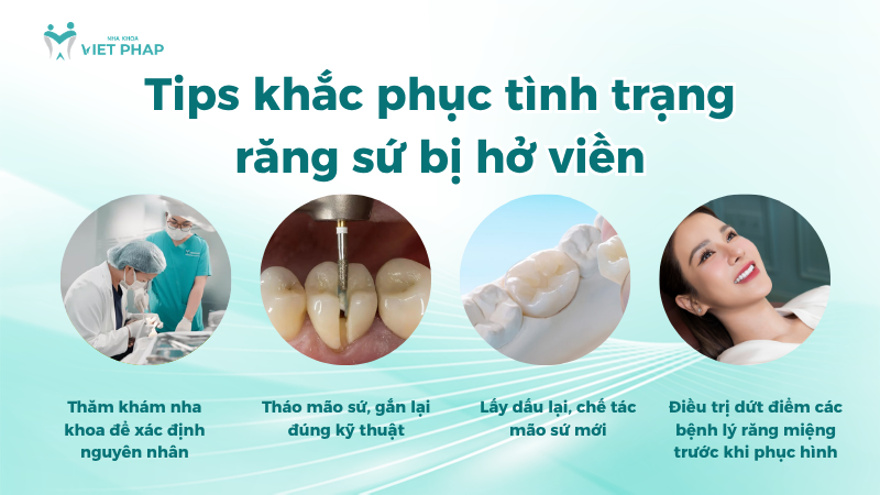 Tips khắc phục tình trạng răng sứ bị hở viền