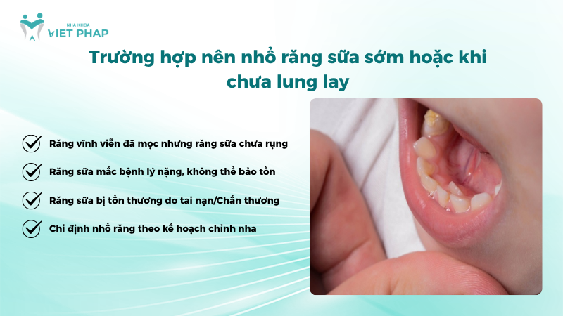 Trường hợp nên nhổ răng sữa sớm hoặc khi chưa lung lay
