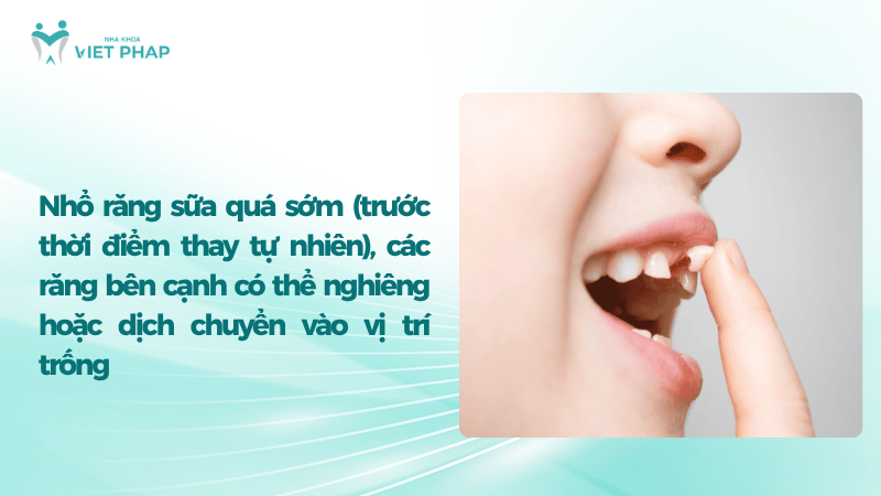 Nhổ răng sữa quá sớm (trước thời điểm thay tự nhiên), các răng bên cạnh có thể nghiêng hoặc dịch chuyển vào vị trí trống