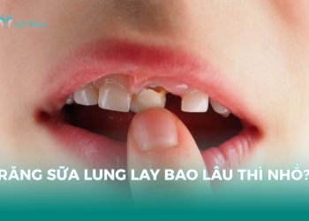Răng sữa lung lay bao lâu thì nhổ