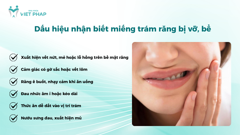 Dấu hiệu nhận biết miếng trám răng bị vỡ, bể