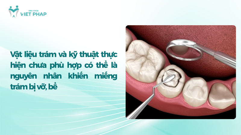 Vật liệu trám và kỹ thuật thực hiện chưa phù hợp có thể là nguyên nhân khiến miếng trám bị vỡ, bể