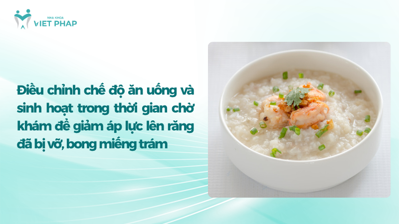 Điều chỉnh chế độ ăn uống và sinh hoạt trong thời gian chờ khám để giảm áp lực lên răng đã bị vỡ, bong miếng trám