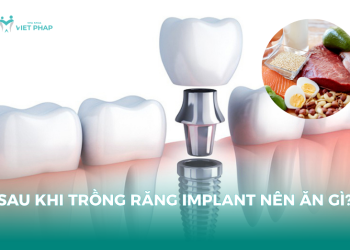 Sau khi trồng răng implant nên ăn gì