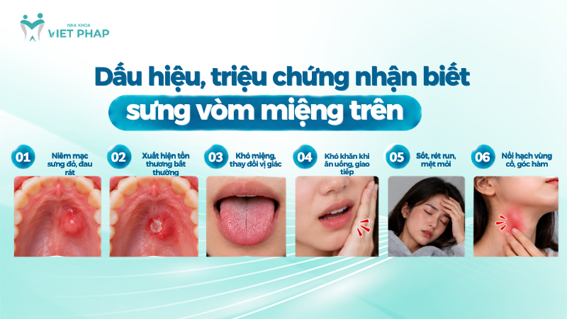 sung vom mieng tren 3 Dấu hiệu, triệu chứng nhận biết sưng vòm miệng trên