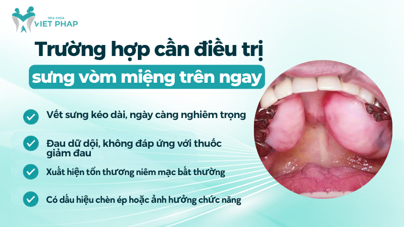 sung vom mieng tren truong hop can dieu tri Trường hợp cần điều trị sưng vòm miệng trên ngay