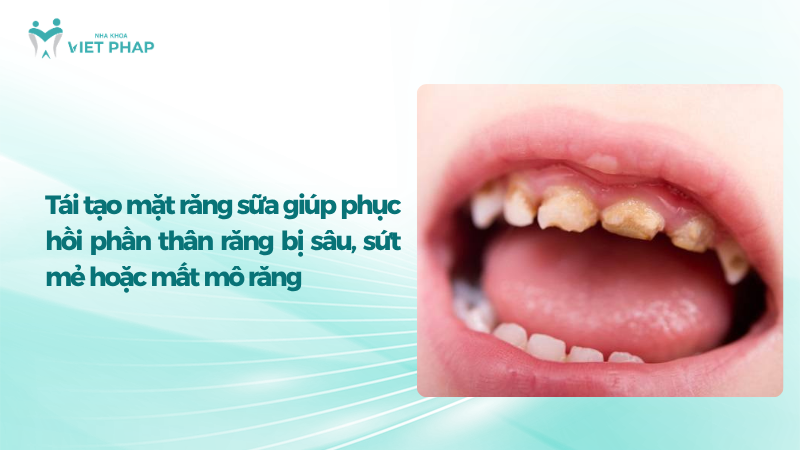tai tao mat rang sua 1 Răng cửa sữa bị sâu, sứt mẻ và mất mô răng cần được thăm khám phục hồi