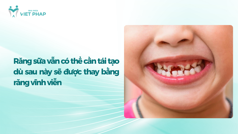tai tao mat rang sua 3 Trẻ trong giai đoạn thay răng sữa bằng răng vĩnh viễn