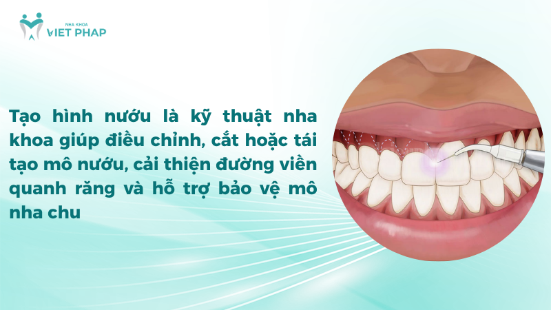 Tạo hình nướu là kỹ thuật nha khoa giúp điều chỉnh, cắt hoặc tái tạo mô nướu, cải thiện đường viền quanh răng và hỗ trợ bảo vệ mô nha chu