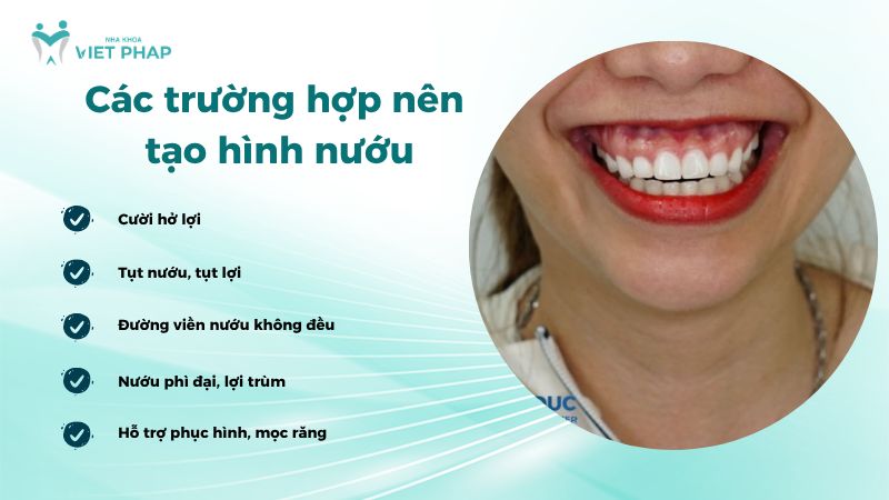 Các trường hợp nên tạo hình nướu