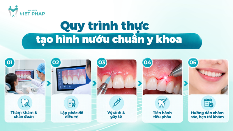 Quy trình thực hiện tạo hình nướu chuẩn y khoa