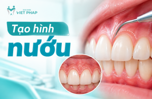 Tạo hình nướu khi nào? Lợi ích, phương pháp, quy trình và cách chăm sóc sau phẫu thuật