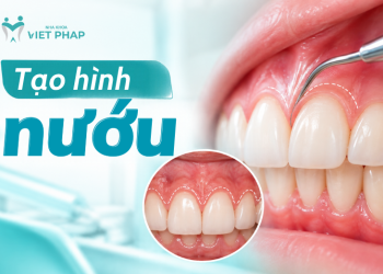 Tạo hình nướu khi nào? Lợi ích, phương pháp, quy trình và cách chăm sóc sau phẫu thuật