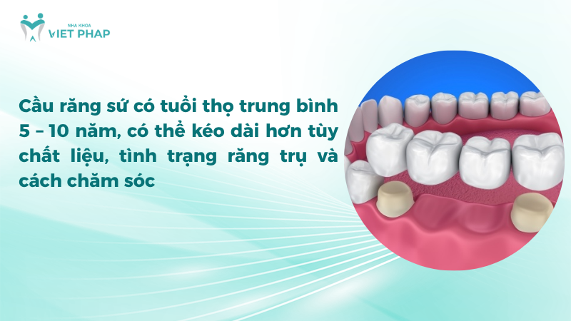Cầu răng sứ có tuổi thọ trung bình 5 – 10 năm, có thể kéo dài hơn tùy chất liệu và cách chăm sóc