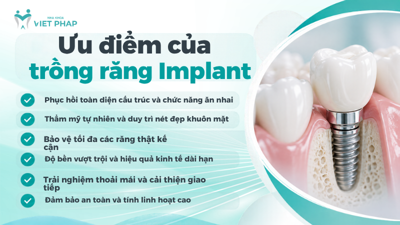 6 ưu điểm của trồng răng Implant: phục hồi ăn nhai, thẩm mỹ tự nhiên, bảo vệ răng kế cận, bền lâu, thoải mái và an toàn