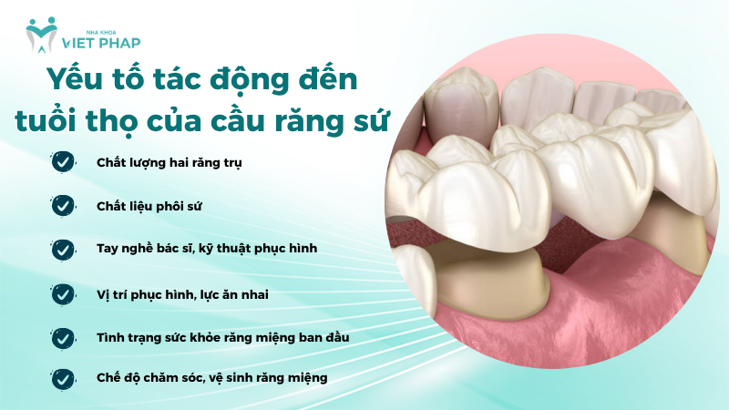 6 yếu tố tác động đến tuổi thọ của cầu răng sứ